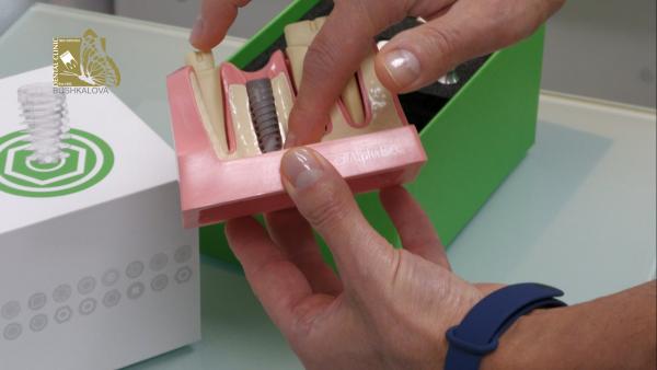 Модерна система за зъбни импланти прилагат в Медико-дентален център Естетика в Стара Загора (ВИДЕО)