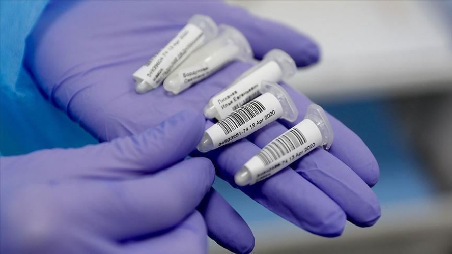 603 нови случая на коронавирус в неделя от направени 4 602 PCR теста