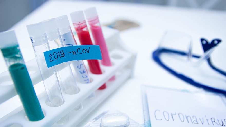 227 нови случая на коронавирус за денонощието и 15 починали