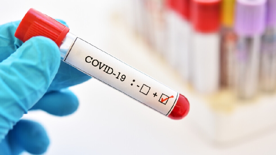 Отново спад на новите случаи и починалите от коронавирус за денонощие