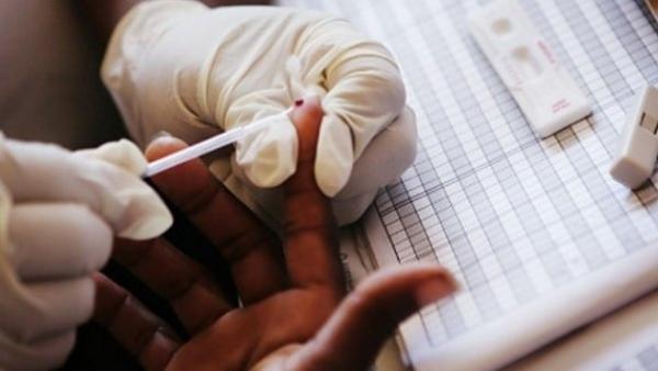 Учени излекуваха втори пациент от вируса на ХИВ и от рак